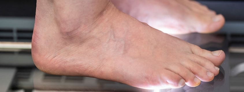 Fußscan zur Analyse der Fußsohlen